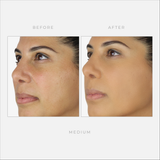 Instantly conceal the appearance of darkness and imperfections with one swipe. Advanced formula provides a supple, comfortable finish for a more unified skin tone that lasts 8 hours. FREE OF
Cruelty-Free, Vegan-Friendly, E.U. Registered, and Made in the USA.
Formulated without Alcohol, Barley, Corn, Oats, Rye, Soy, Spelt or Wheat.
Free Of Parabens, Gluten, Phthalates, Oil, Fragrance, Sulfates, and GMO.